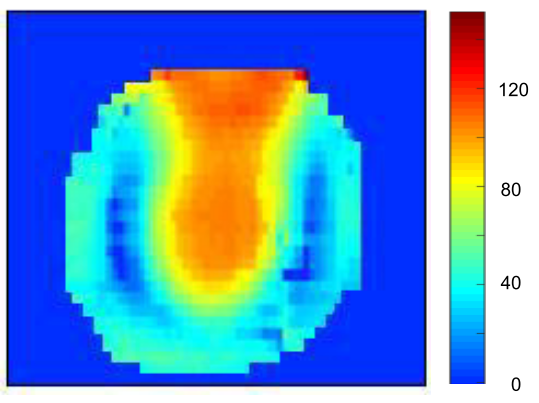 Le système à haut champ 11,7 T Iseult pour la plateforme Neurospin