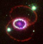 Ping-pong in the surroundings of SN1987A