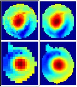 Le projet Iseult pour la plateforme Neurospin 